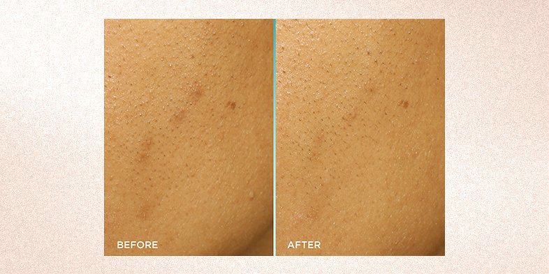 In-Article-how-to-use-glycolic-acid-on-face_2